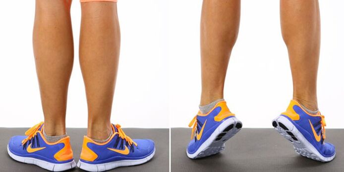 Gymnastics for varicose veins